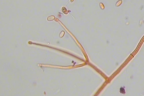 Verticillium rexianum